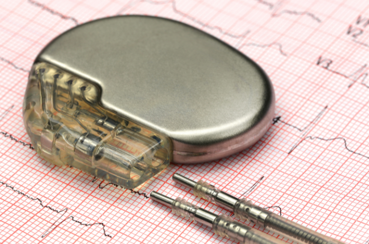 Permanent Pacemaker