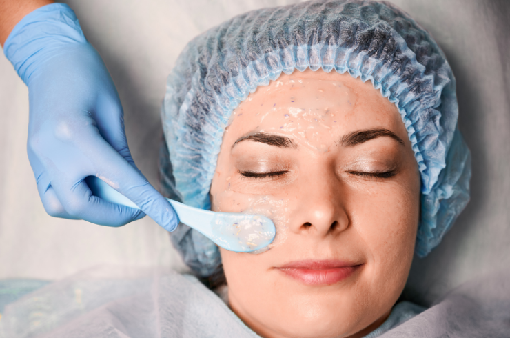 Chemical Peeling Treatment