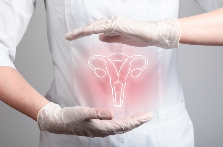 Endometriosis