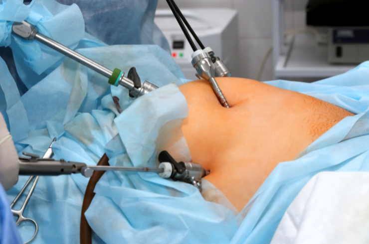 Advanced Laparoscopy & Hysteroscopy